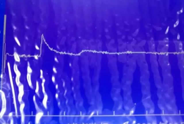 �h(yu��n)����ʾ�}�_�yԇ����